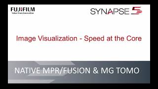 Synapse 5 eBrochure