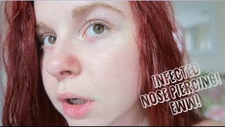 Infected nose piercing, putting the tree up & a lot of time lapses!
enjoy guys!
____________________________________________________________ support
this cha...