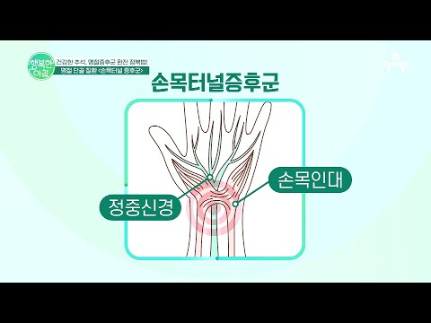 가장 대표적인 명절 <strong>증후군</strong>, <strong>손목</strong> <strong>터널</strong> <strong>증후군</strong>! 손목터널 <strong>증후군</strong> 예방법은? | 행복한 아침 922 회