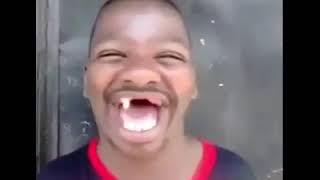 orang gila gigi ompong