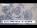 한타바이러스, 코로나처럼 퍼질까?..."국내 영향 제한적" / YTN