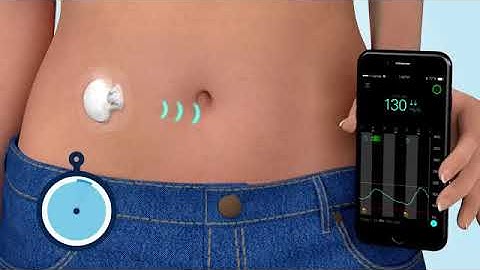 What is Continuous Glucose Monitoring (CGM)