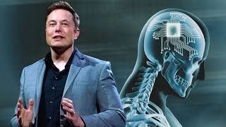 Neuralink Starts the Human Trials? Here is 10 Reasons Why it will Change Humanity Forever!