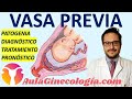🩸 VASA PREVIA⚡: PATOGENIA, DIAGNÓSTICO, TRATAMIENTO, PRONÓSTICO👶🏼... - Ginecología y Obstetricia -