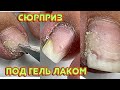 Сюрприз под гель лаком  😕 Отошел ноготь / Педикюр