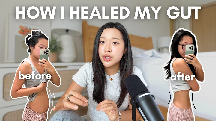 How fixing my GUT HEALTH changed my life | bloating, acne, fatigue thumbnail