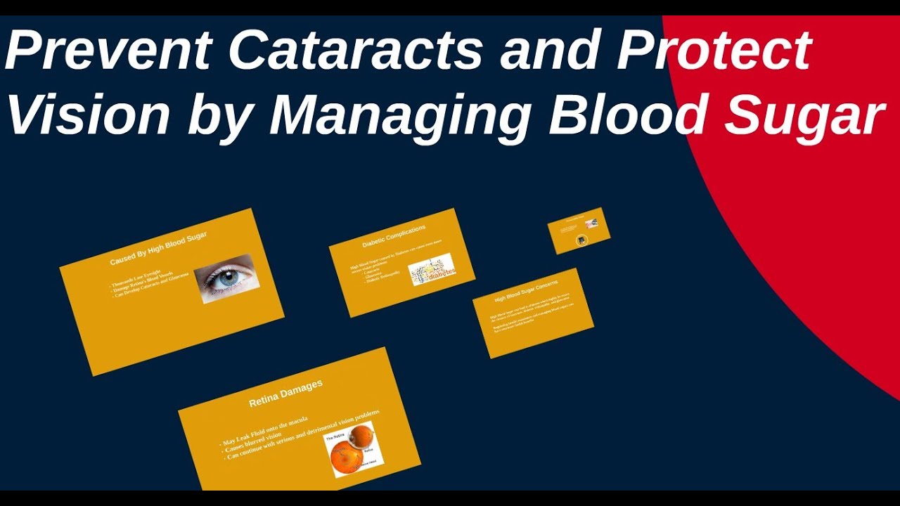 Prevent Cataracts and Protect Vision by Managing Blood Sugar YouTube