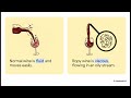 Wine 099 Lactic Acid Bacteria Alterations and Sensory Defects in Wine