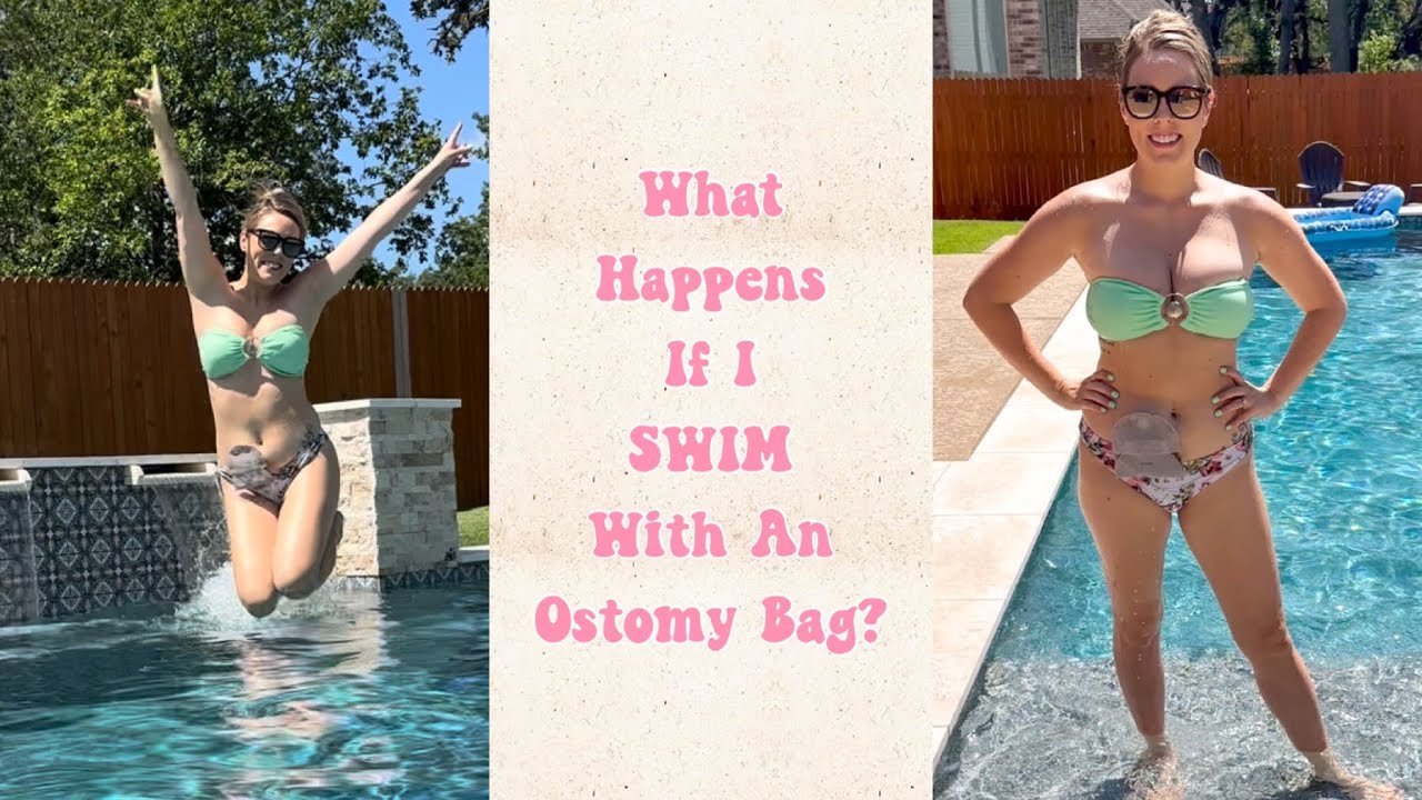 Swimming with an Ostomy Bag: Tips for a Secure Seal & Longer Wear Time