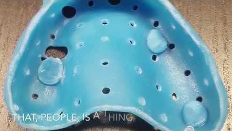 Dental Implant Custom Impression Tray Fabrication