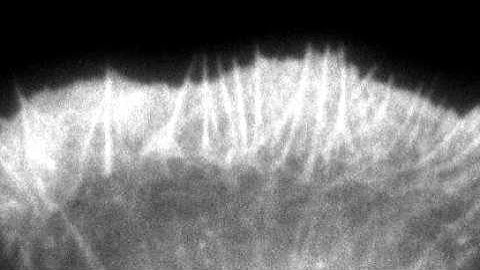 Lamellipodium: protrusion and retraction