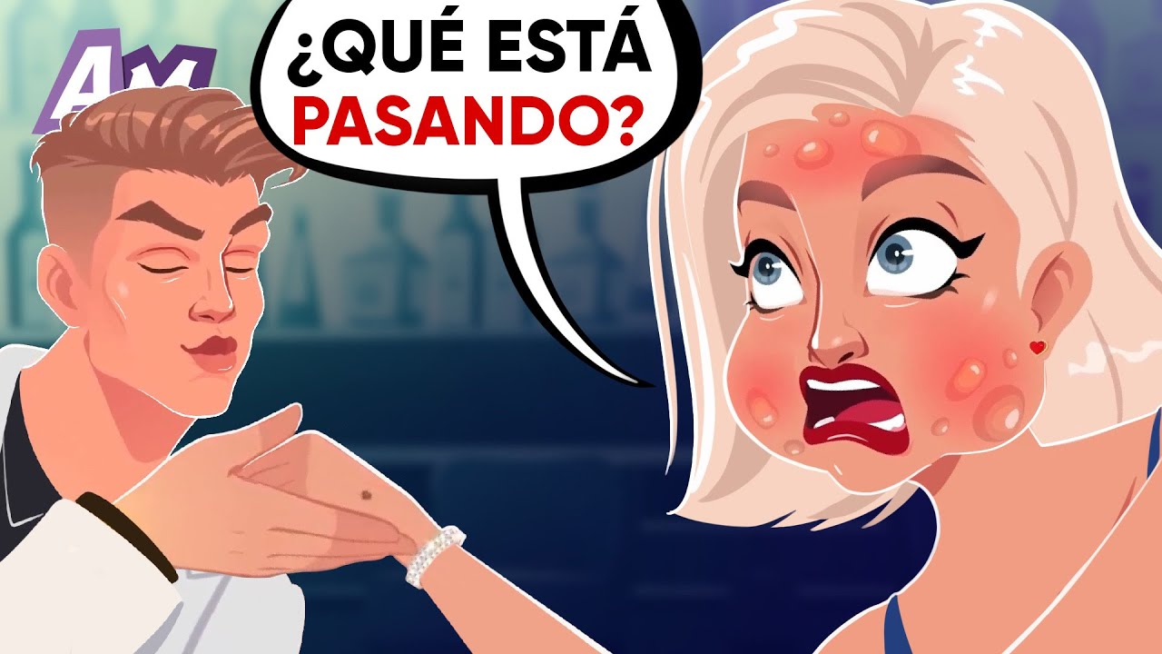 Mi Cara Se Hinchó El Doble Por El Beso De Mi Prometido