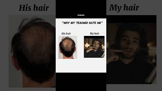 Your eye shape~Your personality||#shorts #zaynmalik #mogger #zayn