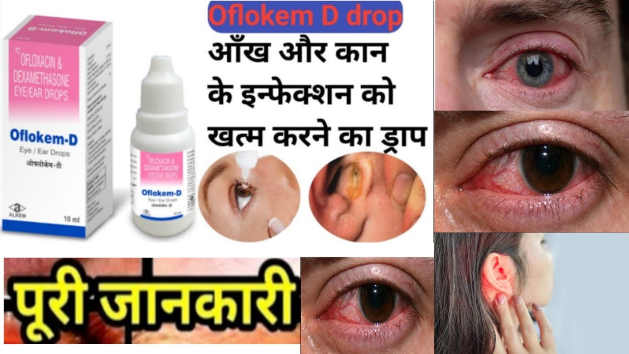 OflokemD Eye/Ear Drop Full Review Use Of OflokemD Eye/Ear Drop