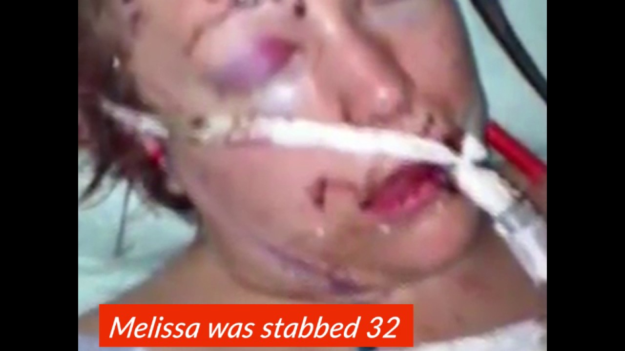 camera iphone 8 plus apk Woman Marries First Responder Who Saved Her Life