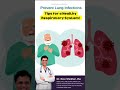 Tips for a healthy respiratory system  dr ravi shekhar