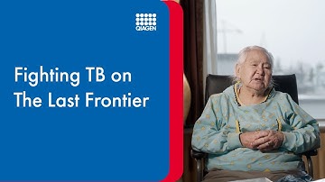 Fighting TB on the last Frontier