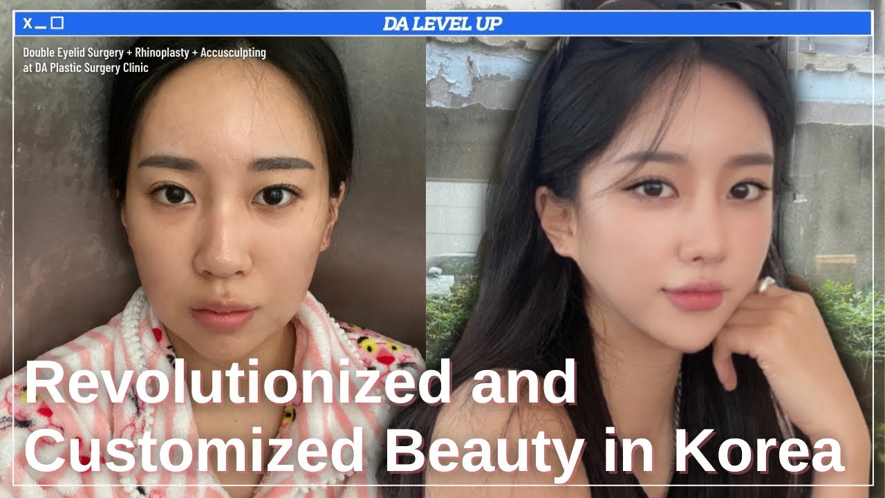 [Plastic Surgery Korea] Revolutionized and Customized Beauty in Korea at DA Plastic Surgery Clinic!