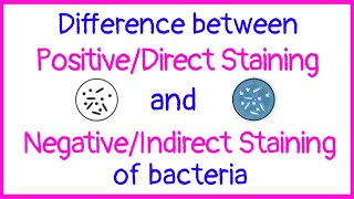 Difference between positive and negative staining or direct and indirect staining |