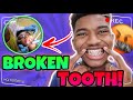 I BROKE MY TOOTH!