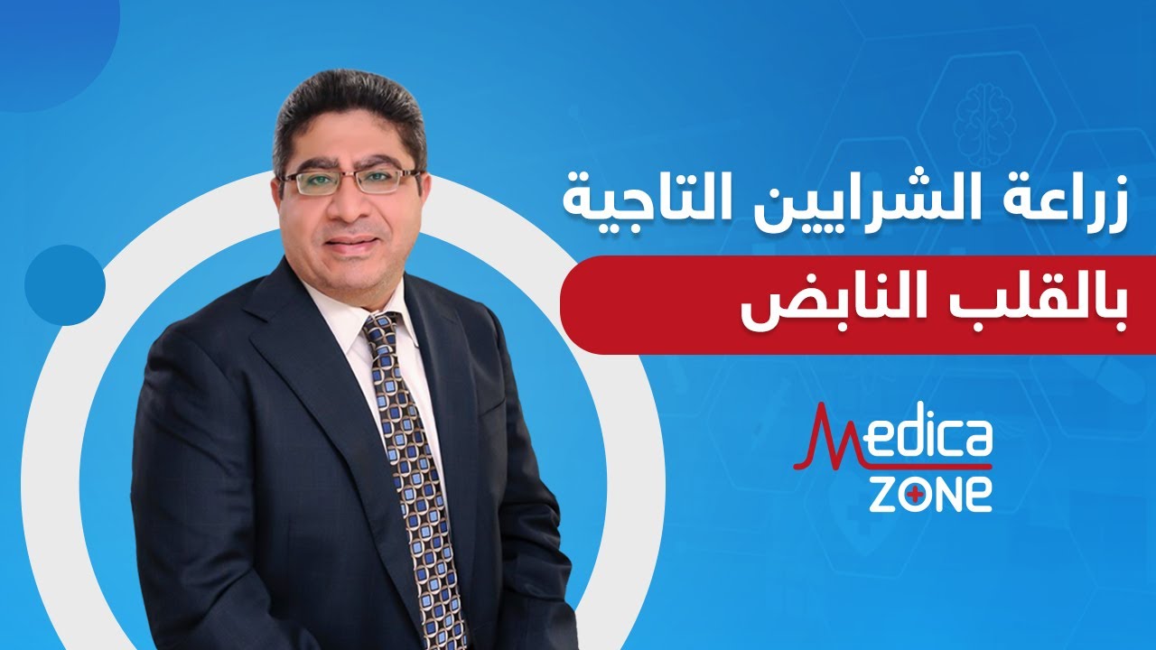 زراعة الشرايين التاجية بطريقة القلب النابض مع الدكتور اسامة عباس | Medicazone