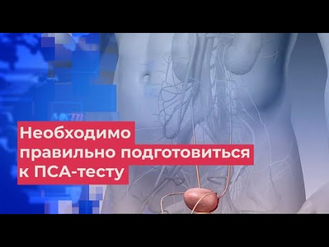 Урологи на видео объяснили, как правильно сдать анализ ПСА