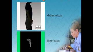 Trauma Overview