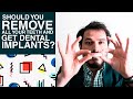 Should you Remove ALL YOUR teeth and GET DENTAL IMPLANTS ?