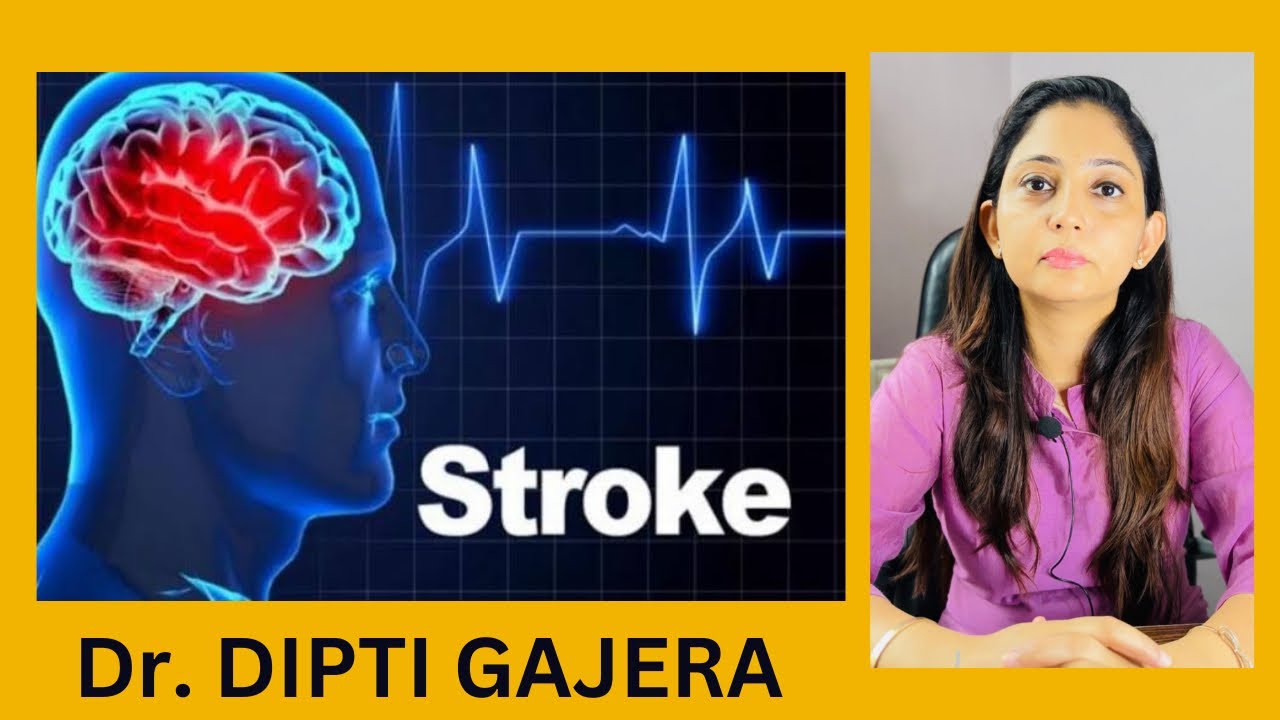 What Is Brain Stroke Causes Of Brain Stroke How To Prevent Brain What is brain stroke causes of brain stroke how to prevent brain