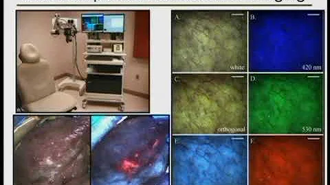 Optical Diagnostic Systems for Precancer: Dr. Rich...