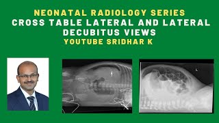 Neonatal radiology l Cross table lateral view l Lateral decubitus view #xray Neonatal radiology l Cross table lateral view l Lateral decubitus view #xray