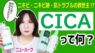 【ニキビ】CICAは肌トラブルの救世主です！＆おすすめの購入方法