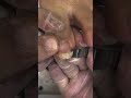 Satisfying Toenail Grooming | Gentle Foot Care Routine #fypシ #cleannails #RelaxingCare #fypシ