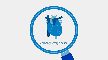 Coronary artery disease integrated solutions across the care pathway