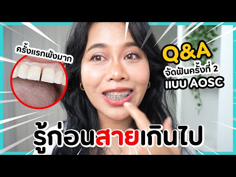 Q&A อัพเดทการจัดฟันครั้งที่ 2 ทำไมต้องจัดแบบ AOSC!! | BEAUTY MOUTHSY