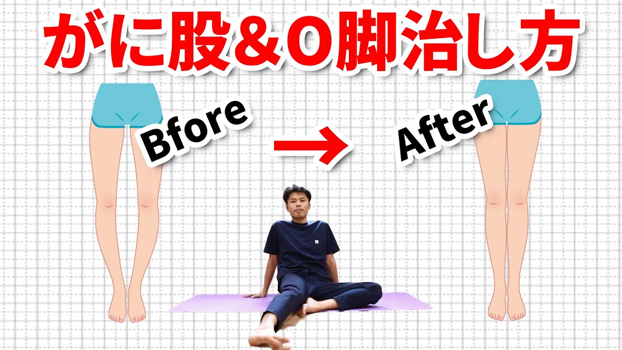 10分 がに股 O脚を簡単に治す矯正方法 東京整体サロン Youtube