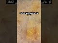 احلي مربي جزر في الشتاء مفيش اطعم من كده احلي مربي جزر في الشتاء مفيش اطعم من كده