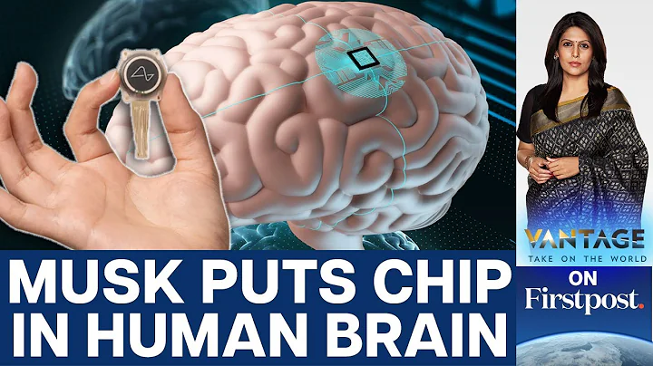 Elon Musk's Neuralink puts First Brain Chip in a Human | Vantage with Palki Sharma