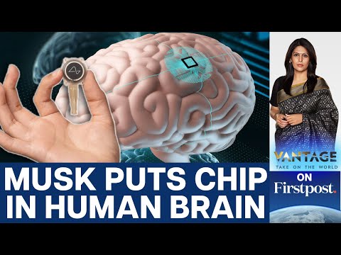 Elon Musk's Neuralink puts First Brain Chip in a Human | Vantage with Palki Sharma