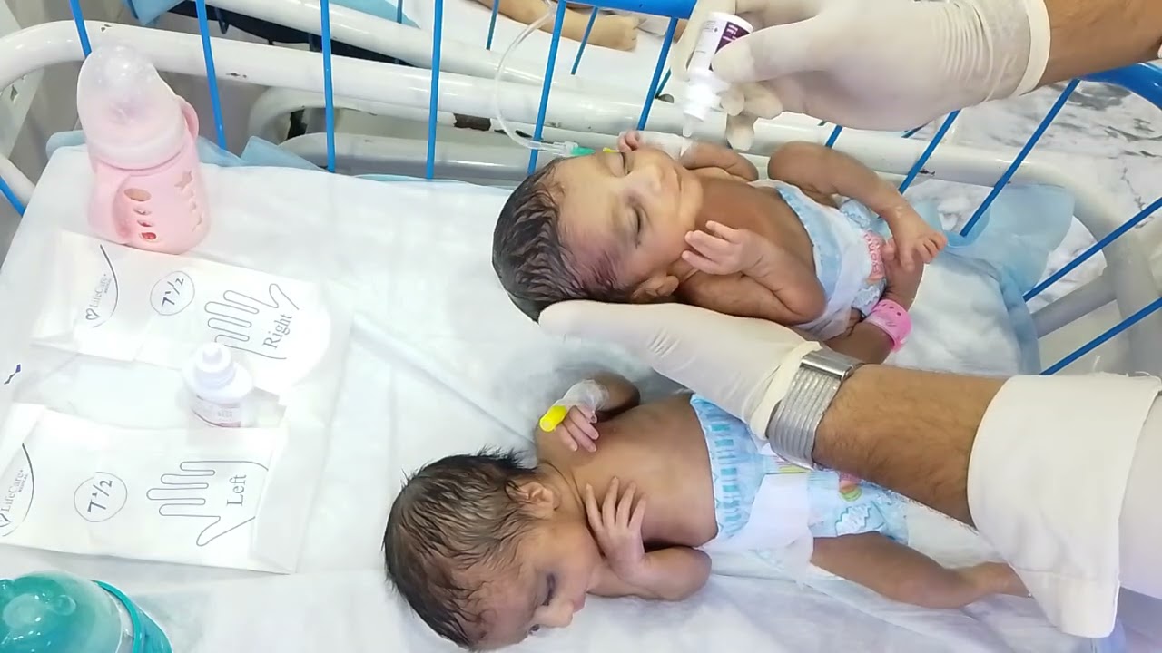 Twins Baby Admitted for Poor Feeding & Vomiting | Anti-Vomiting Drops & Oral Feeding Care