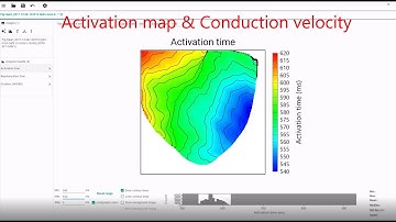 Activation map, Repolarization map and APD map by using BV Workbench
