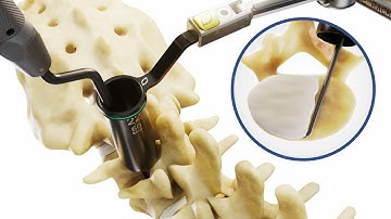 NTS Tube System - Procedural Animation