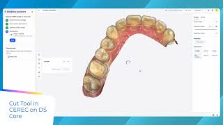 DS Core - Plan Features: CEREC on DS Core – Remove excessive scan data with cut tool