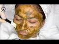 Acne Solution Facial L GULLUNA 