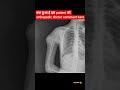 😱 क्या हुआ है इस patient के humures bone में, orthopedic doctor comment kare #patientsreview