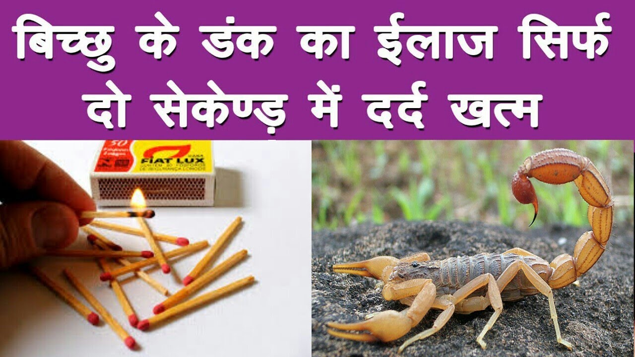 बिच्छू के डंक खत्म हाे जायेगा केवल 2 सेकण्ड में ! देखलो वर्ना पछताओगे || bichu ke dank ka ilaj - YouTube