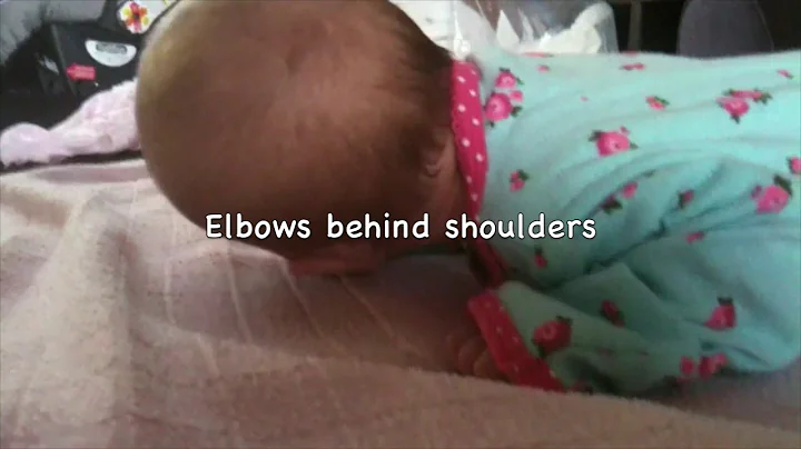 AIMS Evaluation 0 to 3 Months Education and Practice Case 15 Prone Lying