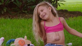 La niña que vive con el corazón fuera del pecho - YouTube