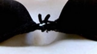 Caved Chest | Embarrassing Bodies