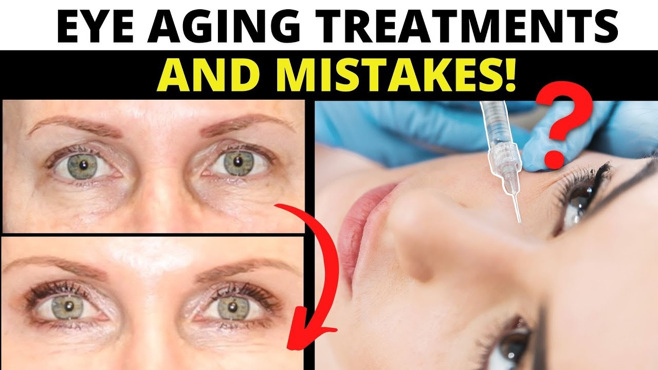 Eye Aging 101: Plastic Surgeon reveals EVERYTHING you need to know about eye aging